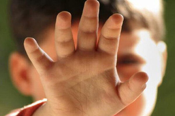 ضرب و جرح عمدی دختر ۴ ساله توسط نامادری سنگدل